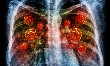 Tanda Utama Pneumonia Akibat Infeksi Bakteri