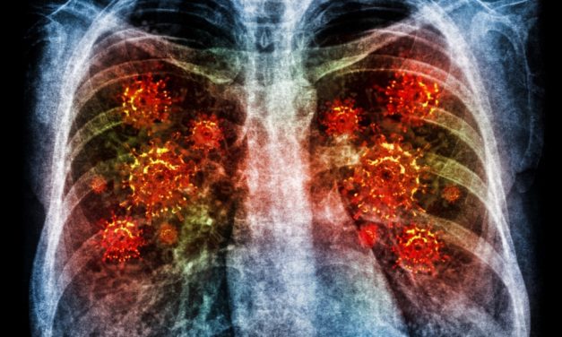 Tanda Utama Pneumonia Akibat Infeksi Bakteri