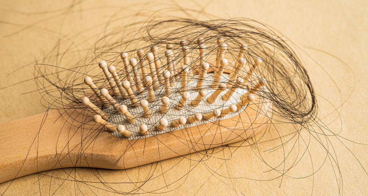 Biotin Ampuh Atasi Kebotakan? Ini Kata Dokter