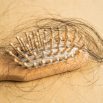Biotin Ampuh Atasi Kebotakan? Ini Kata Dokter