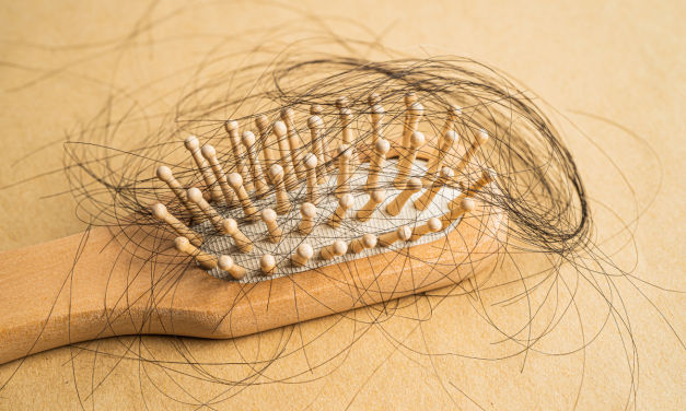 Biotin Ampuh Atasi Kebotakan? Ini Kata Dokter