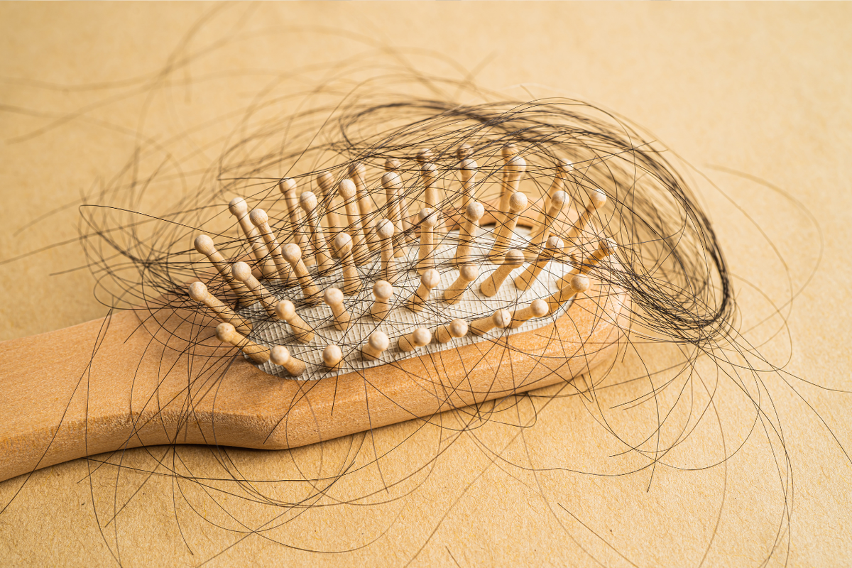 Biotin Ampuh Atasi Kebotakan? Ini Kata Dokter